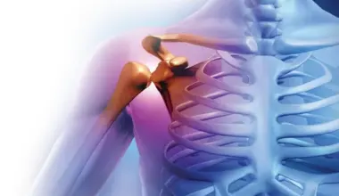 Science Proves the Benefits of a Traditional Brazilian Plant for Treating Arthritis