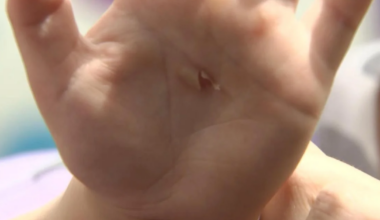 Children suffer chemical burns after being exposed to a hazardous substance on a slide in their Christchurch daycare