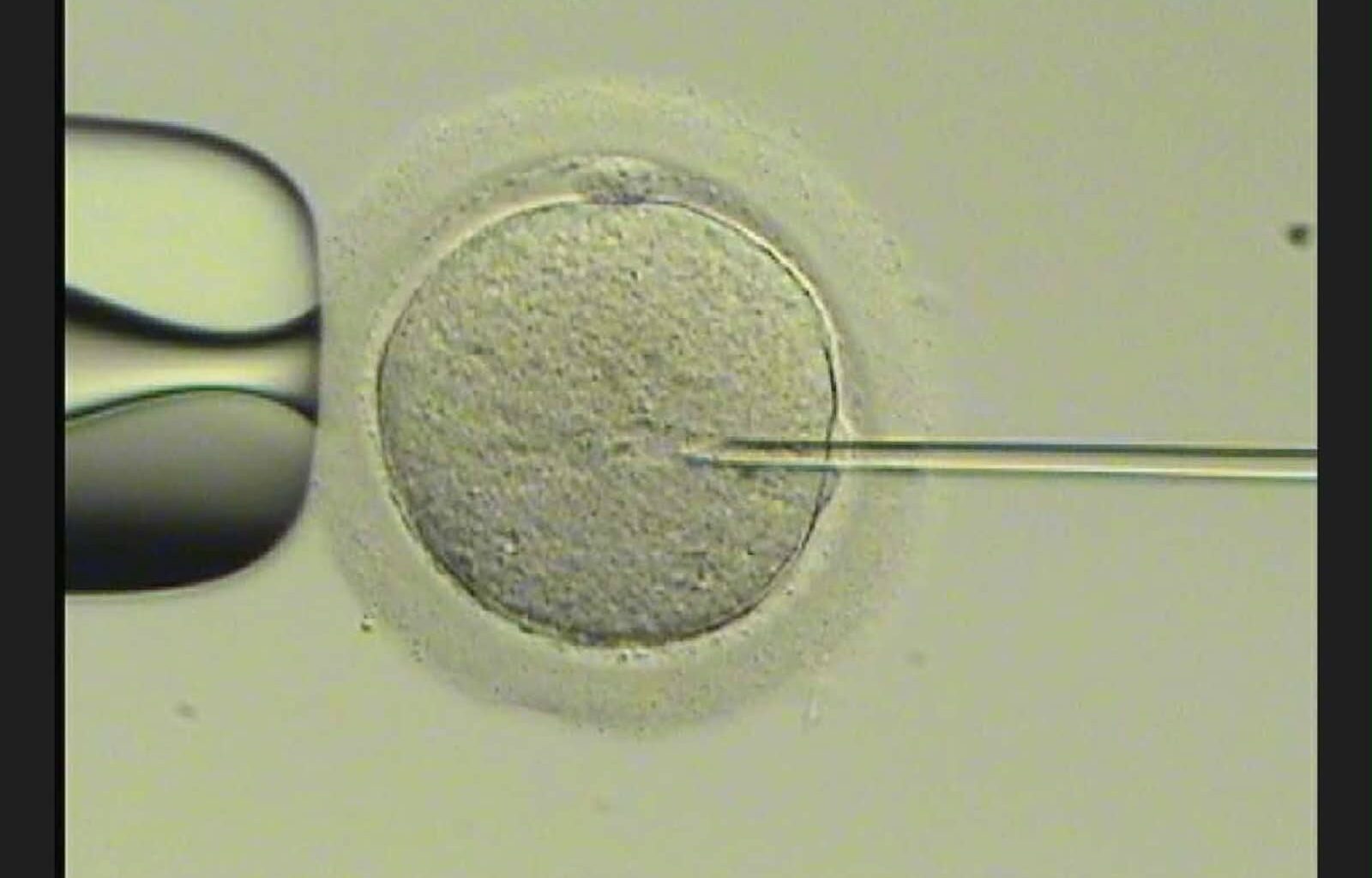 Microscope the place to be as molecules forecast IVF success – Pickr