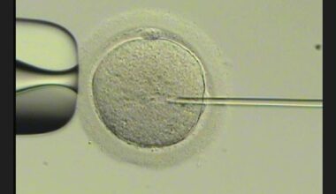 Microscope the place to be as molecules forecast IVF success – Pickr