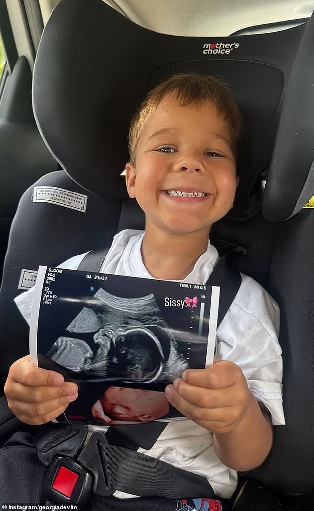 On Friday, Georgia Devlin posted a baby scan on Instagram which showed she is having a girl later this year (pictured)