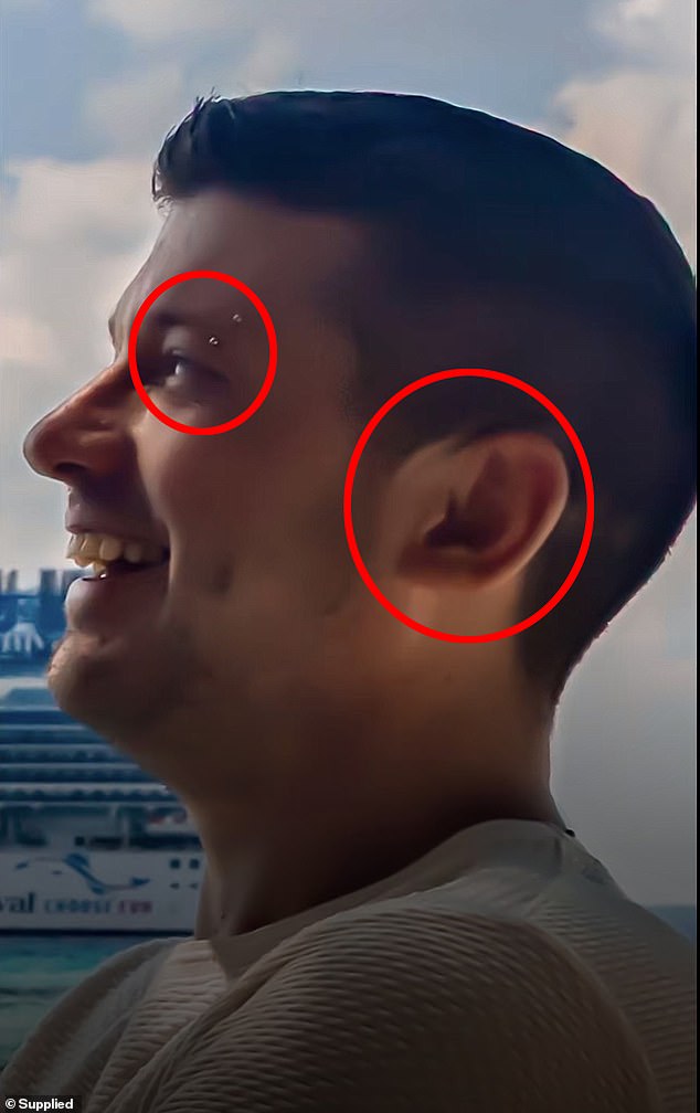 My Baileys iris was missing and his ear had an unusual shape to it