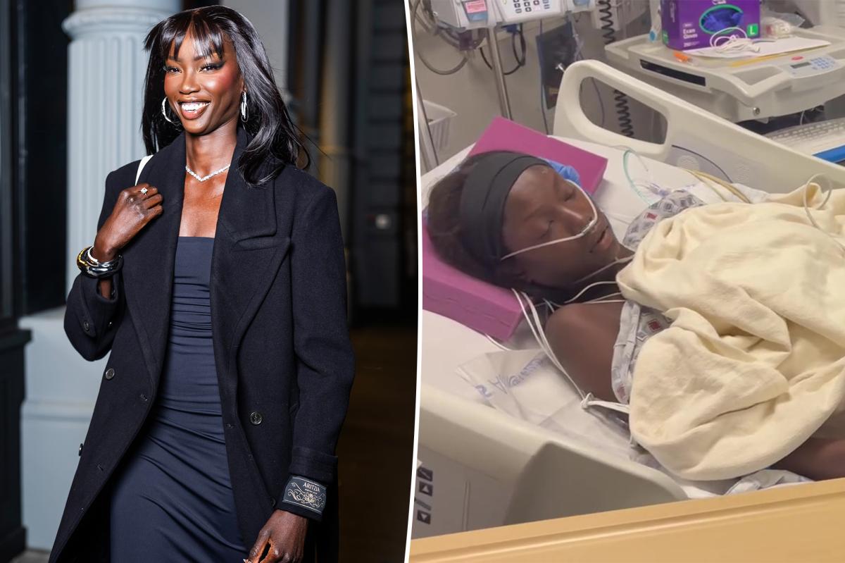 Supermodel Anok Yai, 28, undergoes 'life-saving procedure' due to sepsis following lung surgery