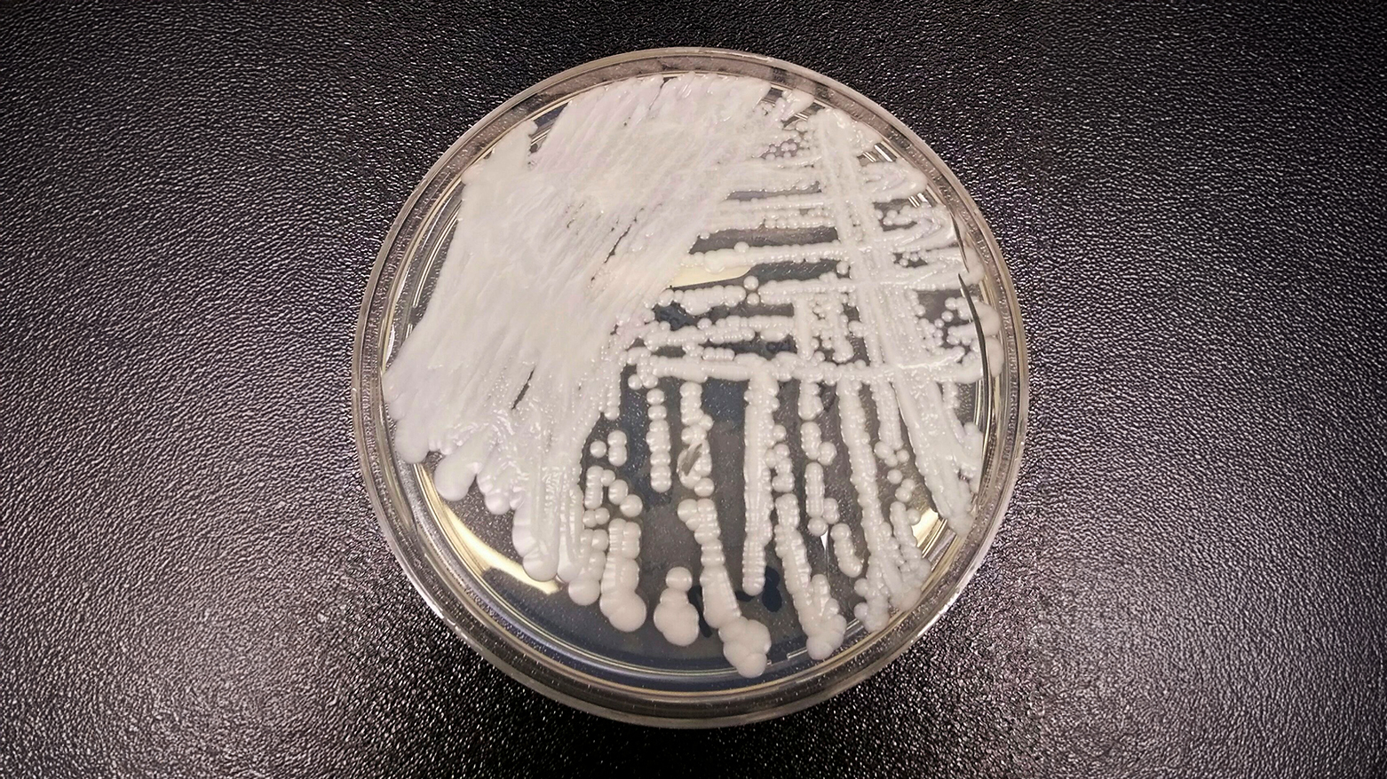 Drug-Resistant Fungus Candida Auris Spreads Globally as Researchers Seek New Treatments
