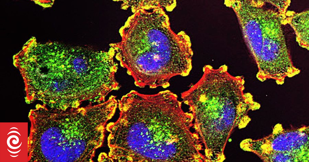 Auckland scientists hope to develop melanoma treatments with million-dollar boost