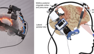 Breakthrough Study Reinforces Vielight’s Red-Light Therapy Technology