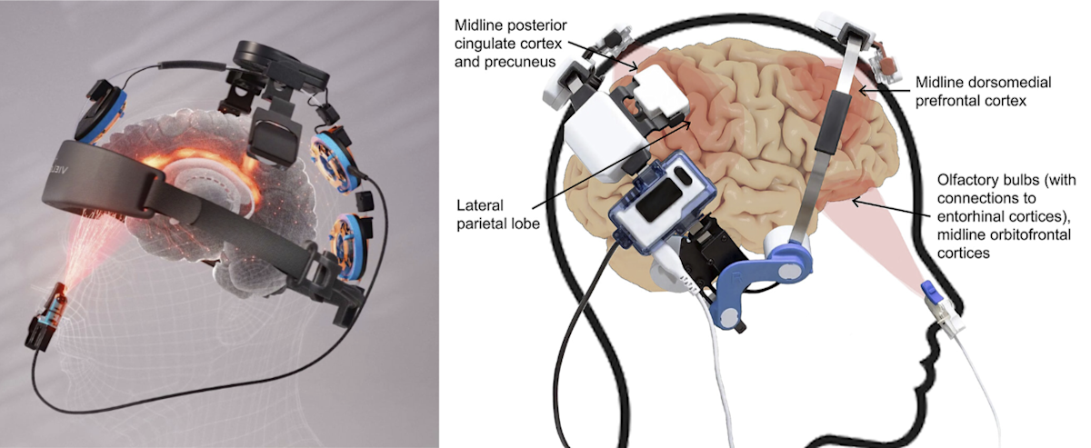 Breakthrough Study Reinforces Vielight’s Red-Light Therapy Technology