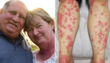 Mother-of-10 airlifted to Sydney intensive care after rare antibiotic reaction