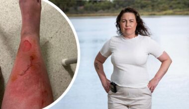 Perth mum Andrea Bowden warning others after jellyfish sting at Peppermint Grove Beach nearly cost her a leg