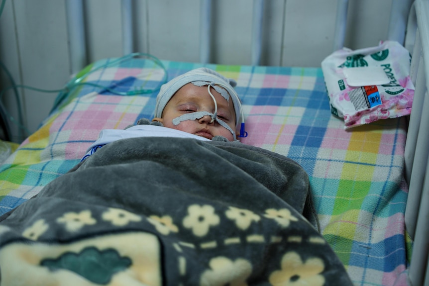 A sleeping baby is monitored in an Afghanistan hospital.