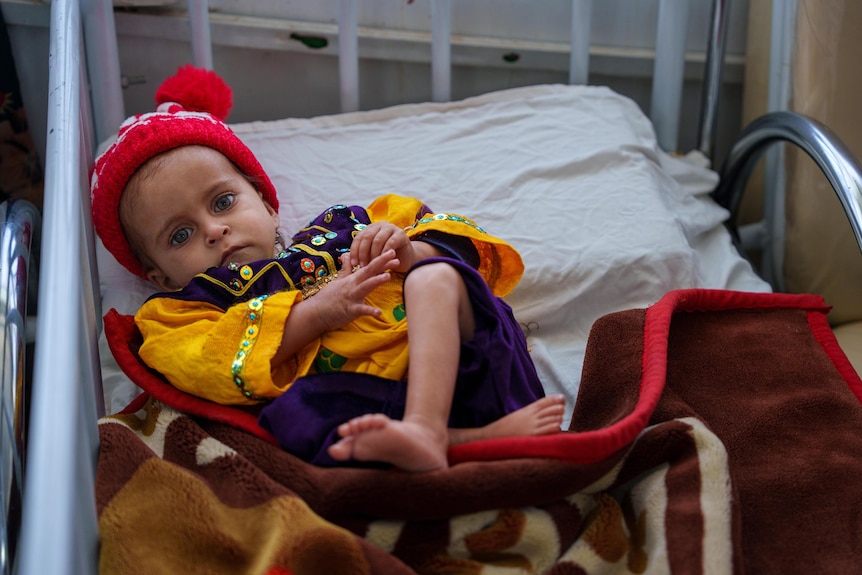 An Afghan child wearing a beanie sits in a hospital cot in Kabul.