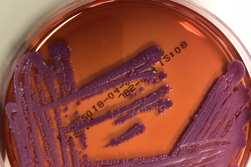 Bacteria in a Petri dish.