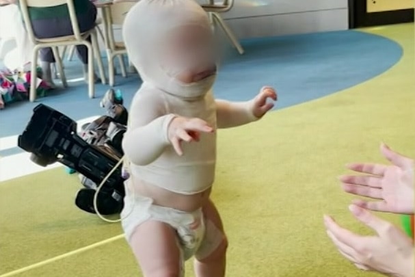 A young boy in burns wraps in hospital walking.