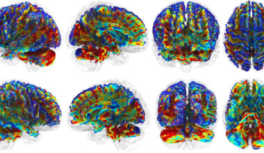 Red light therapy shows promise for protecting football players’ brains – @theU