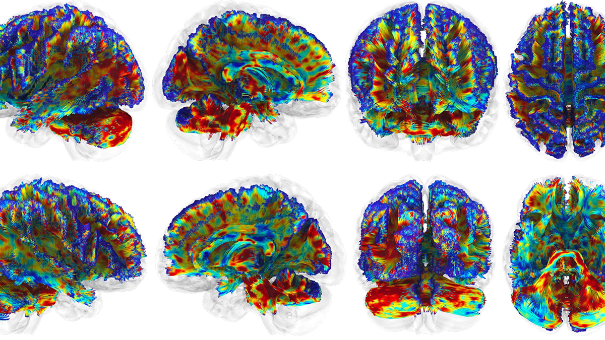 Red light therapy shows promise for protecting football players’ brains – @theU