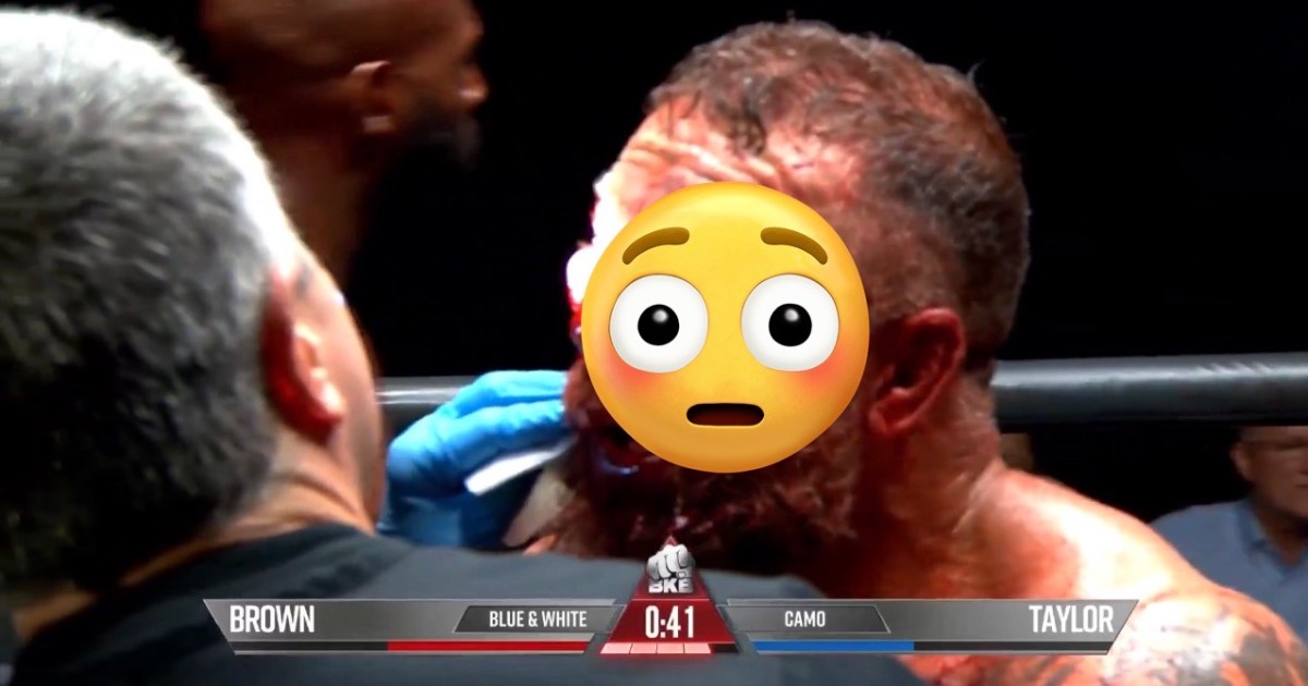 Bare-knuckle war leaves boxer’s face unrecognizable (NSFW)