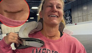Pic: Kayla Harrison neck surgery leaves UFC champ with giant scar