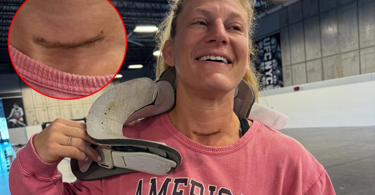Pic: Kayla Harrison neck surgery leaves UFC champ with giant scar