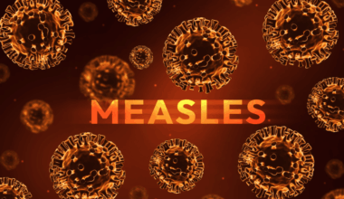 Health officials confirm measles case in Polk County