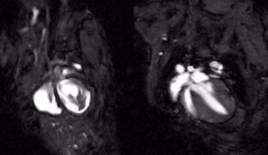 Brighter Side of News