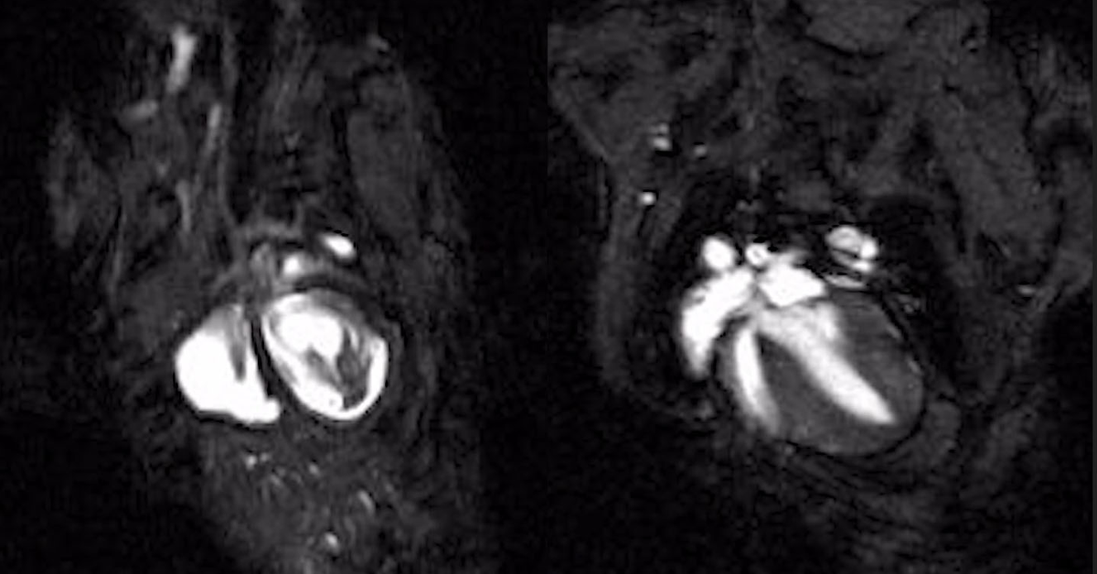 Brighter Side of News