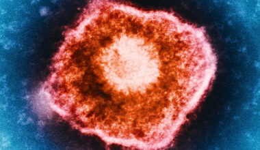 Shingles Vaccine Linked to Slower Biological Aging, Study Finds : ScienceAlert