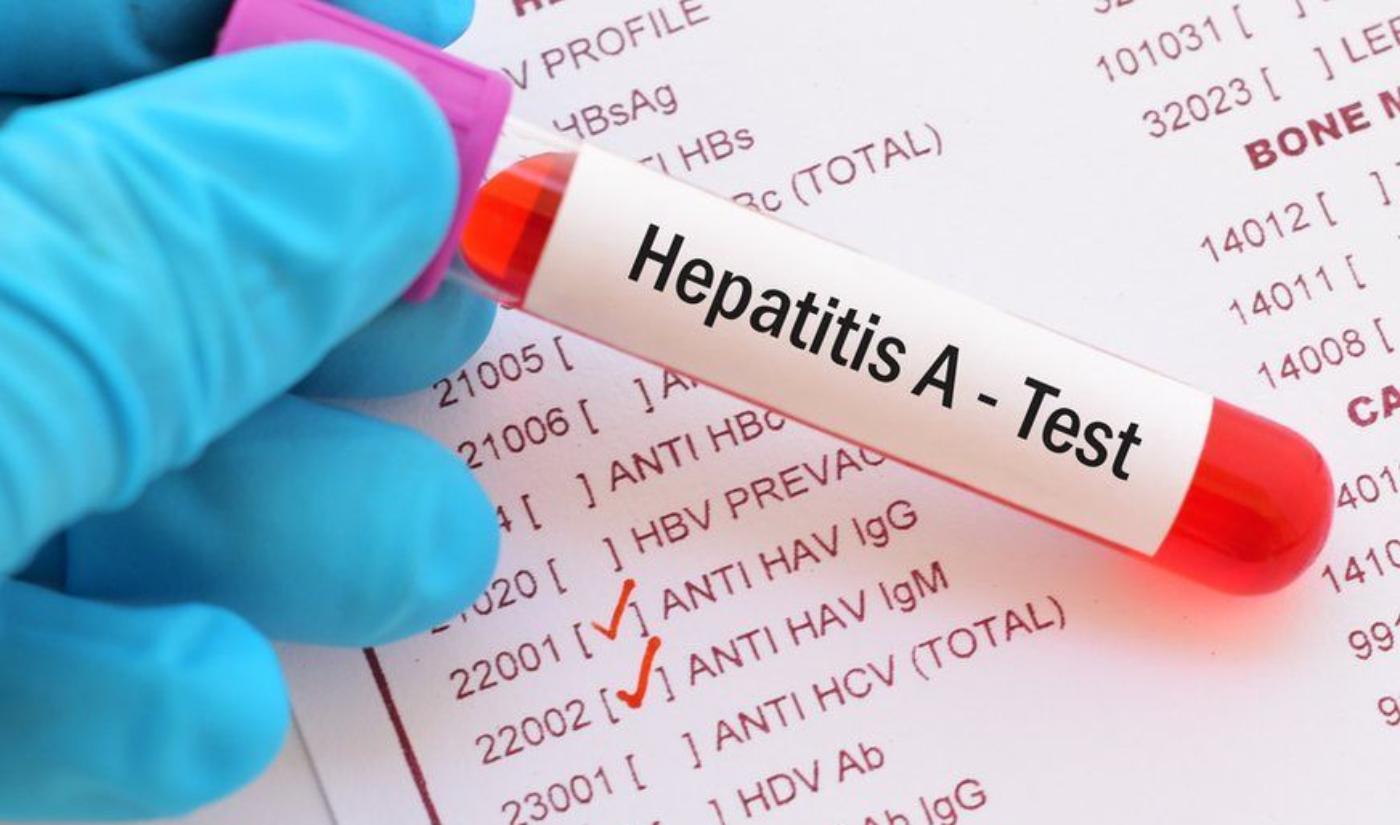 Hepatitis A cases identified in Tamworth