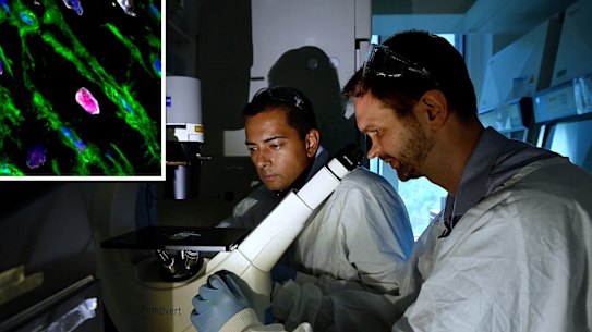 Composite image for Kate Aubusson story on heart attack research. 