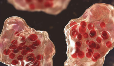 ‘Monitor closely’: Urgent alert for Sydney