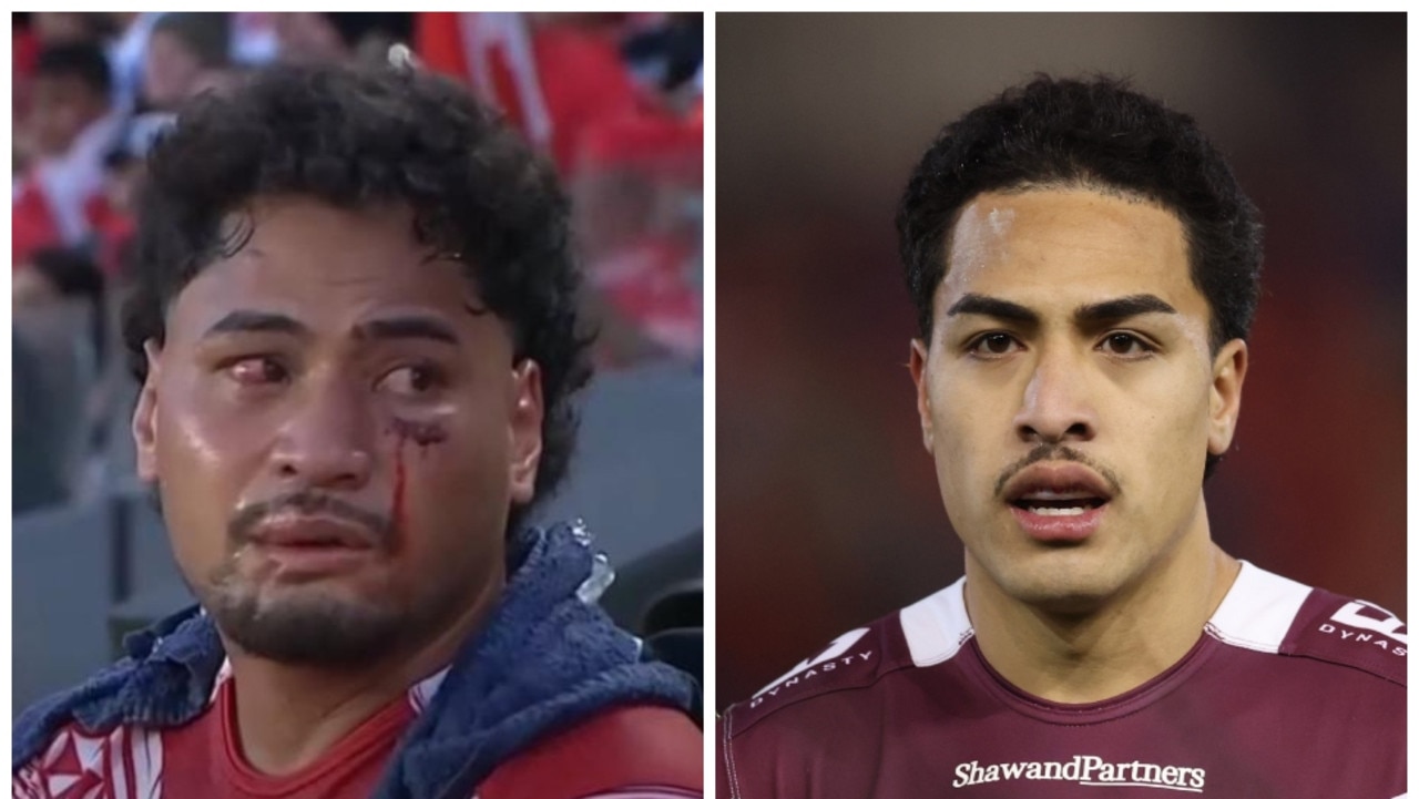 NRL Daily, Lehi Hopoate opens up on collision with Eli Katoa, first of three head knocks, what happened, Tonga, brain surgery, news