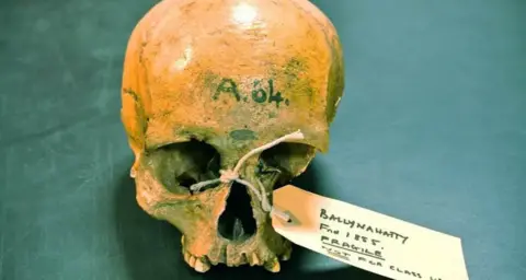 Daniel Bradley, Trinity College Dublin A yellowish skull with the bottom jaw missing. It has A64 written on the forehead. There is a brown tag which says Ballynahatty and Fragile. 