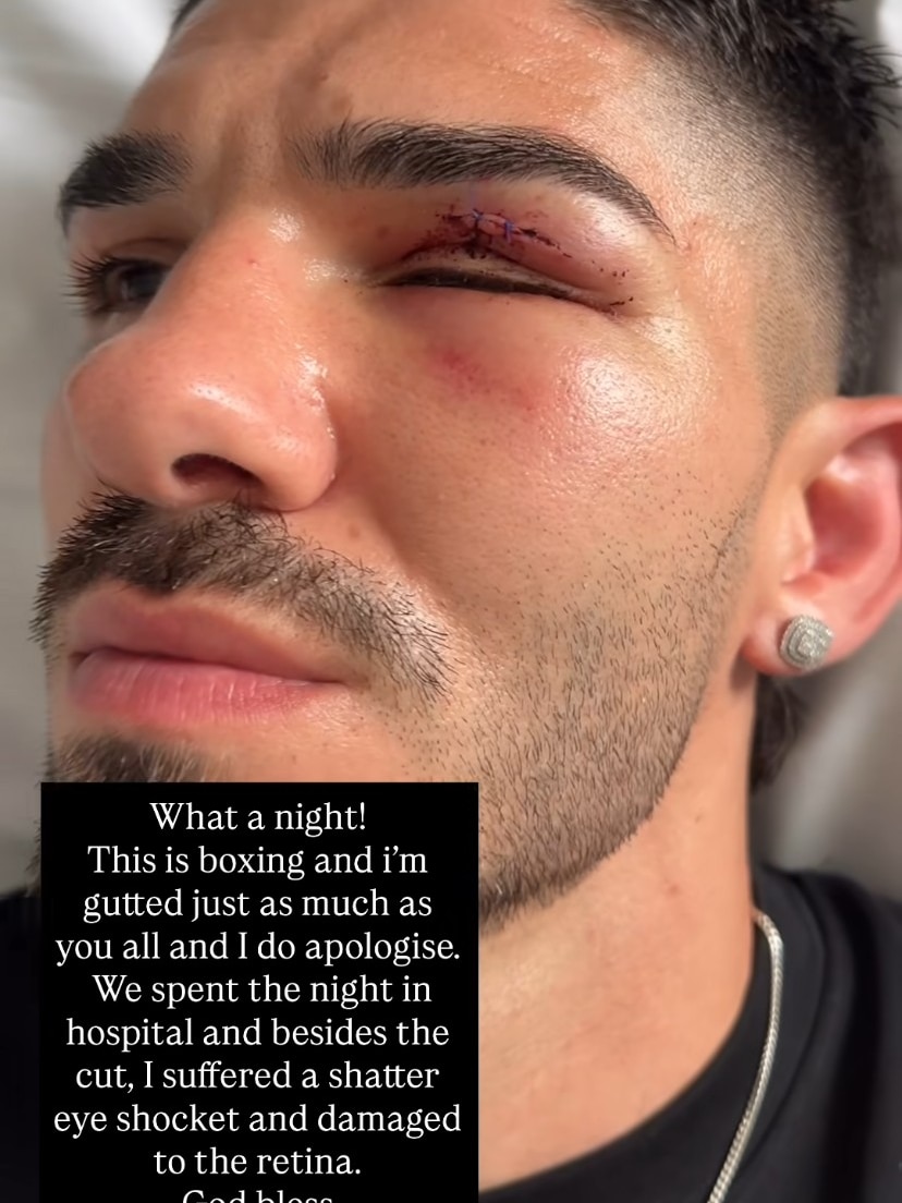 Michael Zerafa instagram post