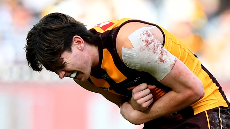 Hawthorn Hawks star suffers shoulder injury at training