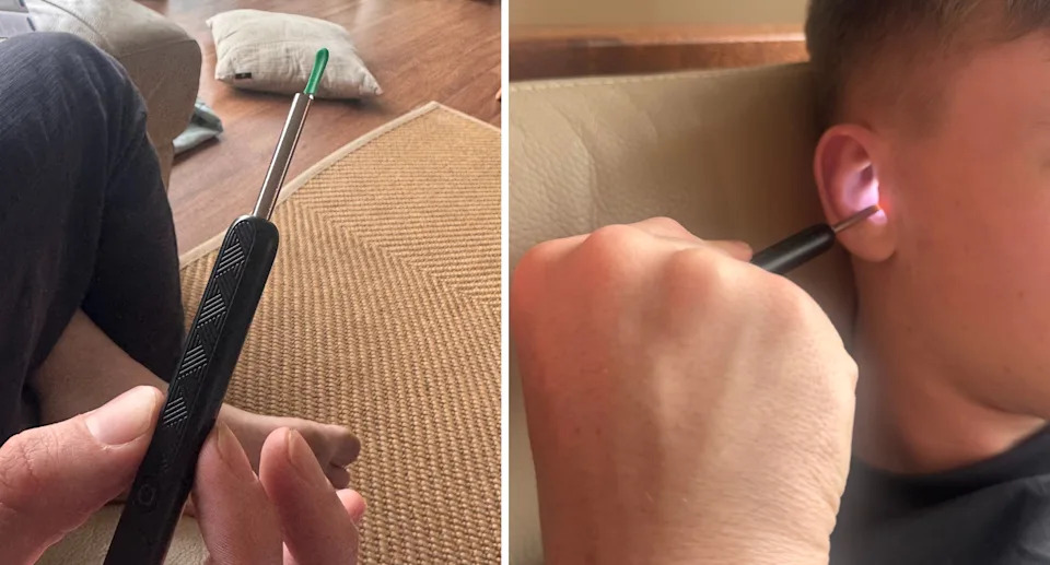 This device only costs a few dollars and has a camera attached so you can see inside your ear, but everyday Aussies might push too far into the canal while trying to remove wax. Picture: Yahoo Australia