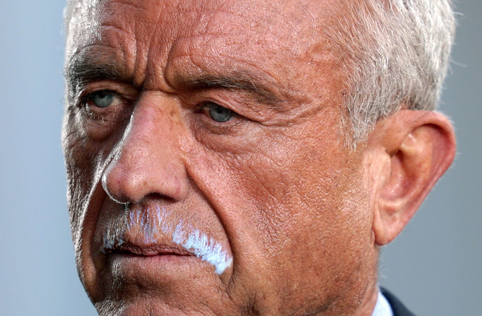 RFK Jr., nutrition: Is whole milk healthy?