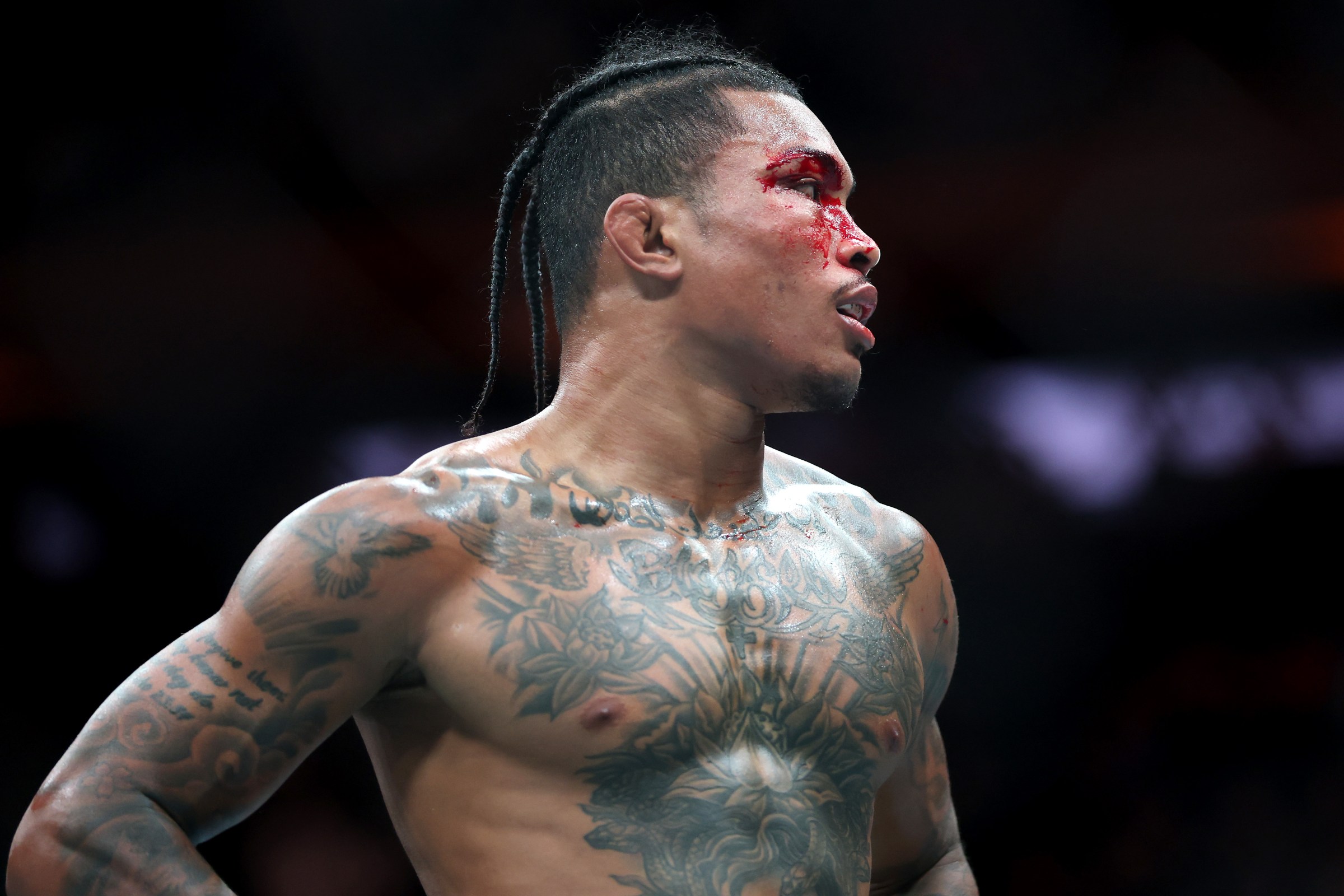 NEW YORK, NEW YORK - NOVEMBER 15: Malcolm Wellmaker of the United States looks on in his fight against Ethyn Ewing of the United States during UFC 322 at Madison Square Garden on November 15, 2025 in New York City. (Photo by Ishika Samant/Getty Images)