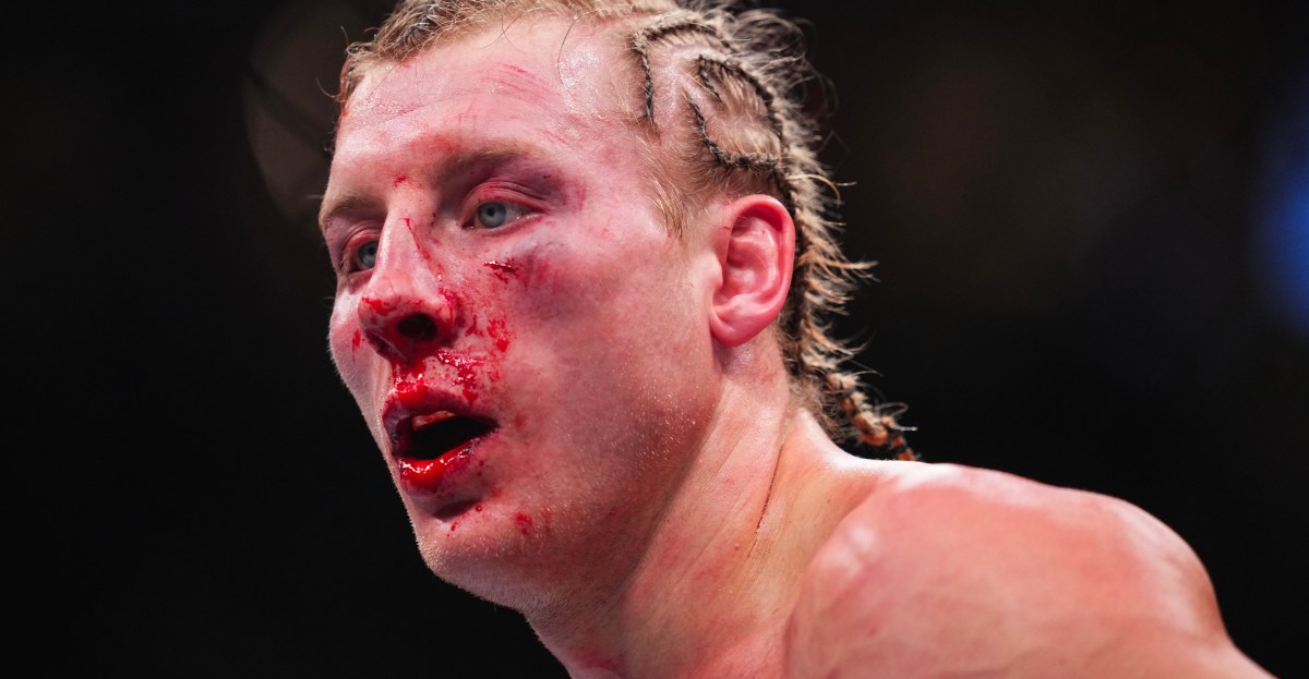 Paddy Pimblett taken to hospital after UFC 324 war