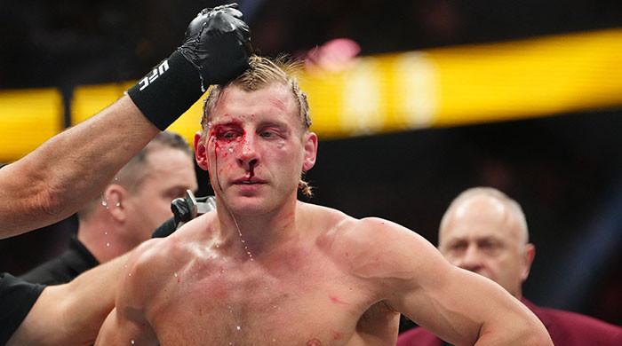 Paddy Pimblett’s health update provided after UFC 324 - MMA