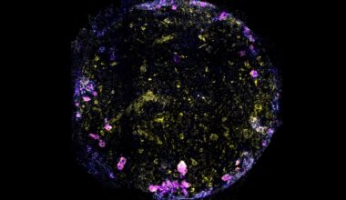 Scientists Made This Lung-on-a-Chip Breathe. Then They Gave It TB. : ScienceAlert