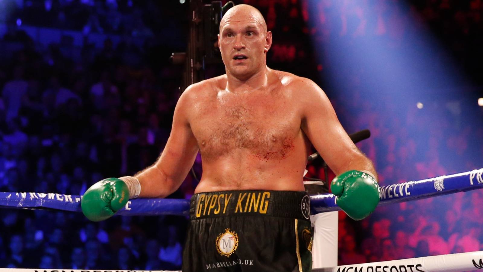 Tyson Fury Shares 10 Hardest Punchers in Heavyweight Boxing History List