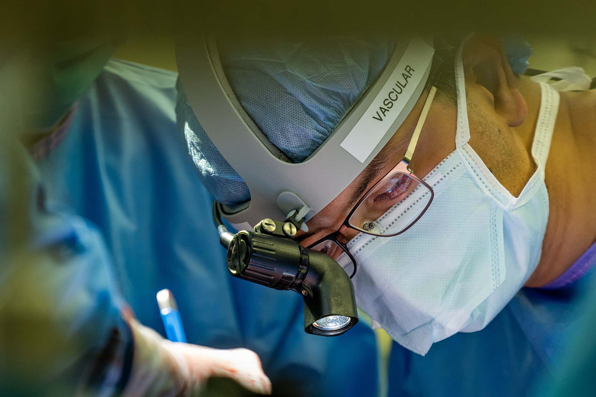 total artificial lung system during double-lung transplant