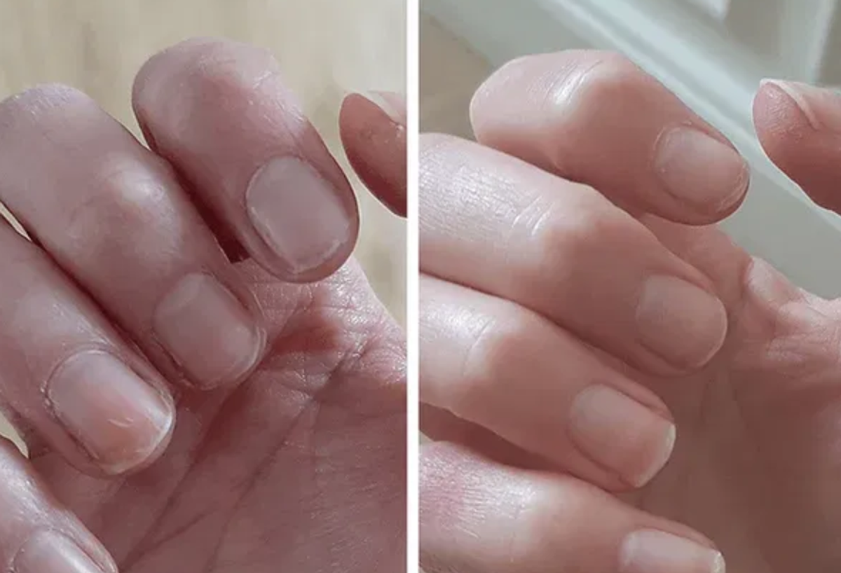 A Reverse Life user's before and after results