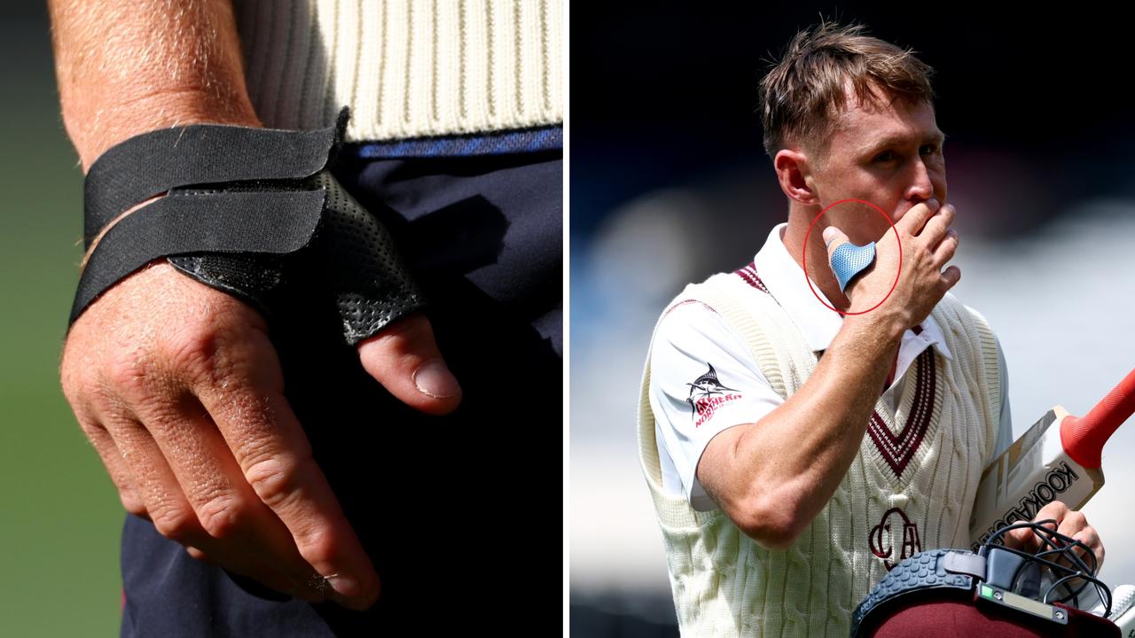Marnus Labuschagne playing through serious hand injury, what happened, Sheffield Shield, signs for PSL team Hyderabad, cricket news, Steve Smith