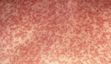 ‘Increased risk’: Major health alert for city