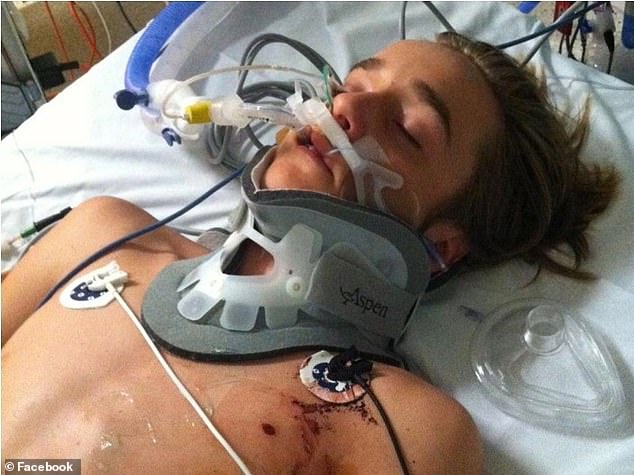 Ryan Meuleman, then aged 15, after he was struck by a car allegedly being driven by Dan Andrews' wife