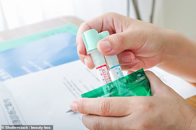 Many scientists are skeptical about how useful at-home gut microbiome kits really are, warning that they can do more harm than good