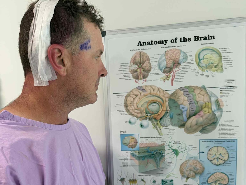 Man with bandaged head looking at brain picture