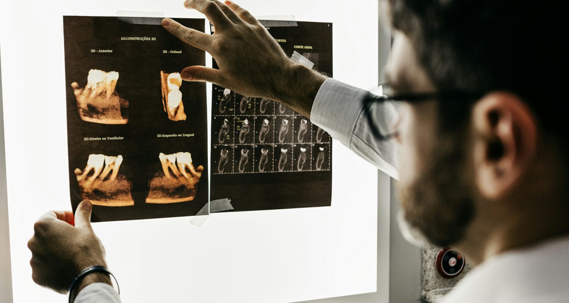 UC Study Unveils Adult Brain Neuron Survival Secrets