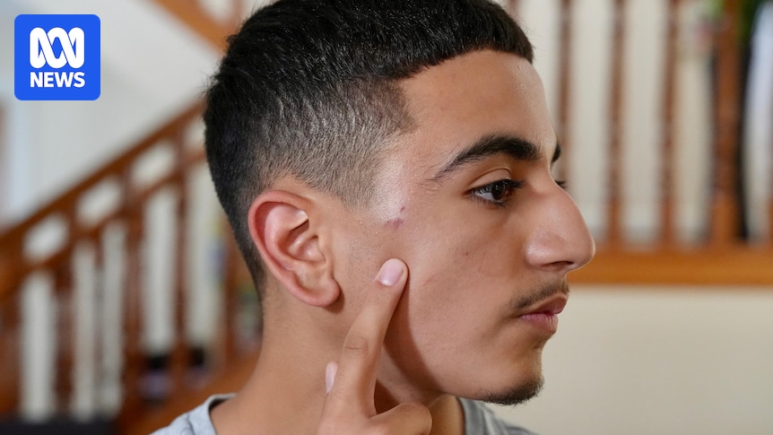 Mother of teenager allegedly assaulted by NSW Police at Sydney protest to press charges