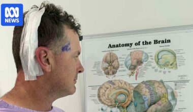 Family push for Sunshine Coast neurosurgery unit after shock brain cancer diagnosis